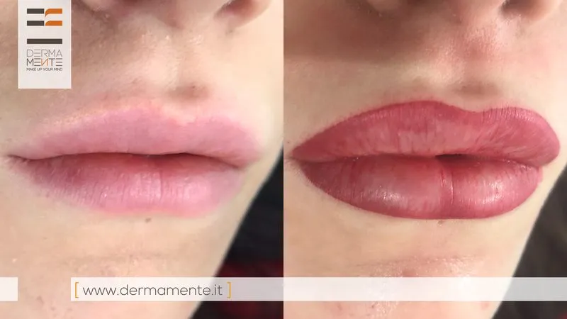Contorno labbra permanente Roma - ridefinizione e simmetria