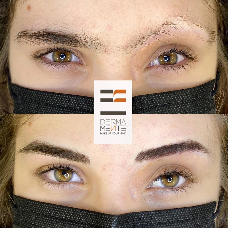 Ricostruzione areola mammaria Roma